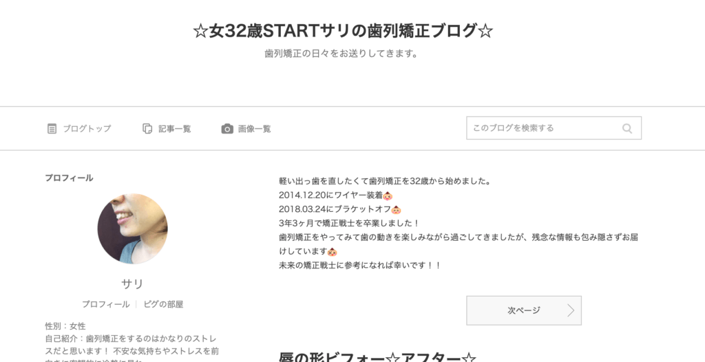 モチベが下がったら読もう【大人の歯列矯正ブログ4選】 ちいさなカタログ